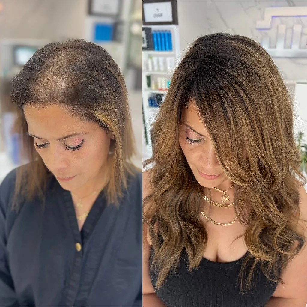 Hair topper transformation