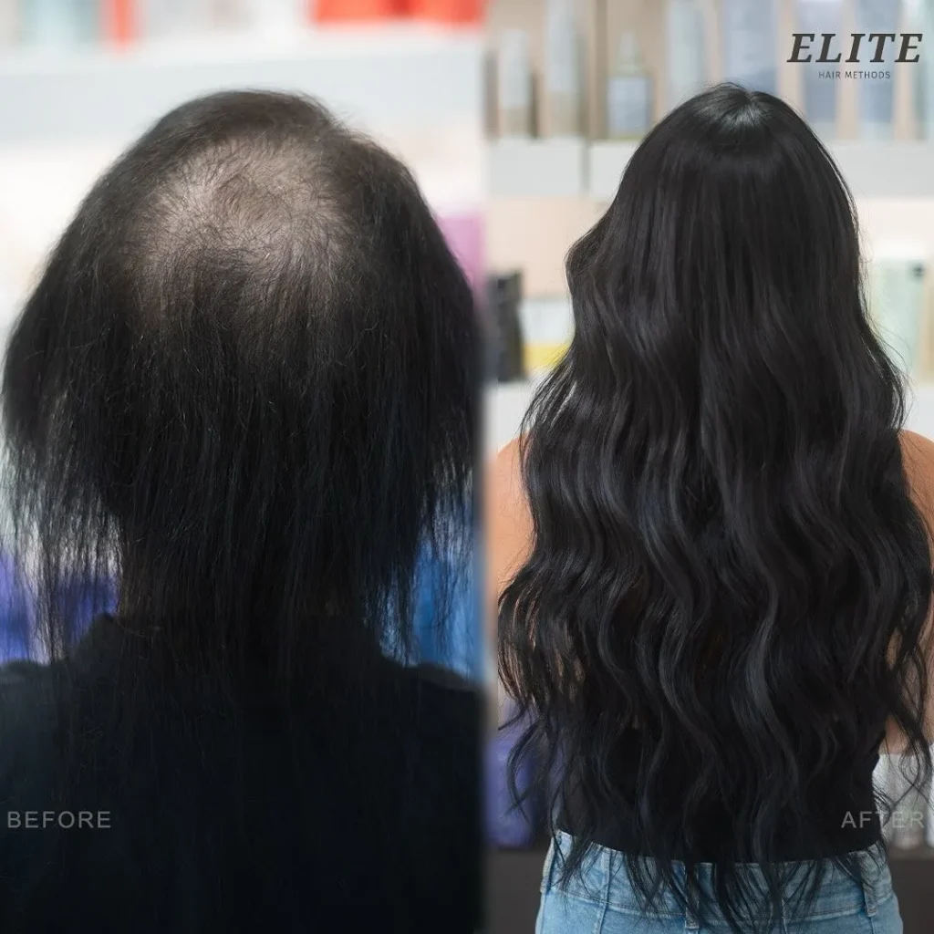 Before and after hair topper and extensions